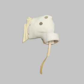 Glenoid Capules Assembly for 1509 Shoulder Series