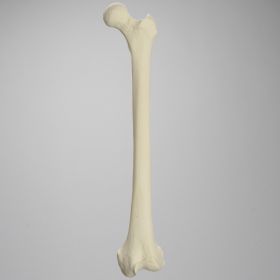 Femur with Arthritis, Foam Cortical, Left, Medium