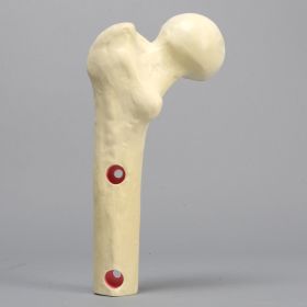 Femur for the Hip Navigation Trainer