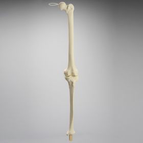 Knee Replacement for Hip Assembly #1301-160