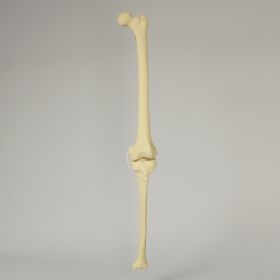 Knee with Three Non-Stretch Ligaments, Full Length