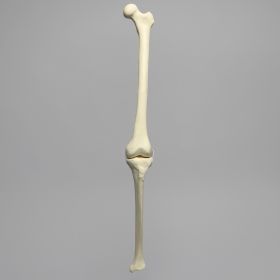 Knee with Three Stretch Cord Ligaments and Narrow Intercondylar Notch, Full Length