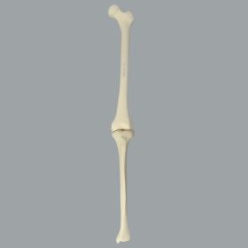 Knee with Three Nylon Non-Stretch Ligaments and Narrow Intercondylar Notch, Full Length