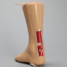 Encased Foot and Ankle with Achilles Ligament