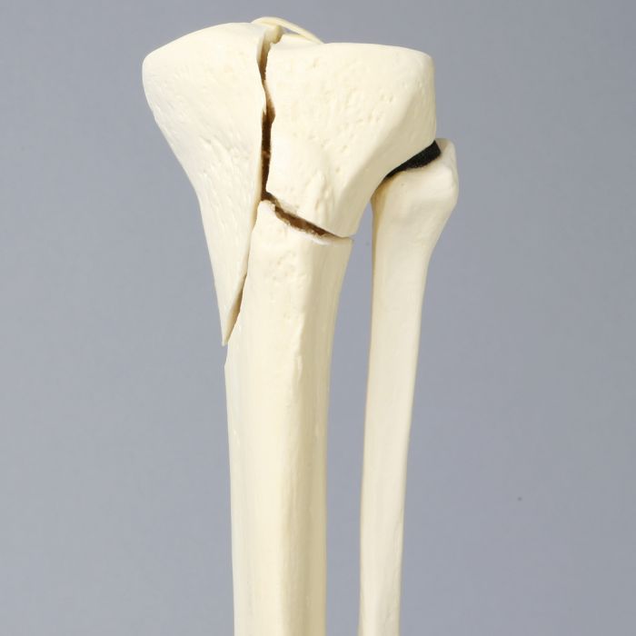 tibia and fibula