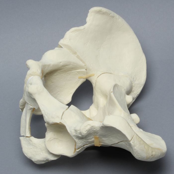 Pelvis with 
