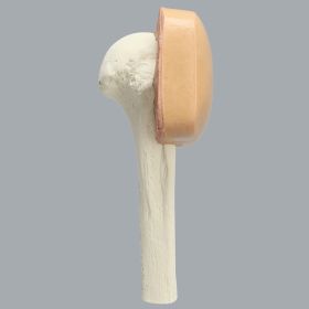 Humerus with Skin Patch, Proximal