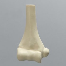 Distal Pediatric Elbow for Wire Navigation Trainer