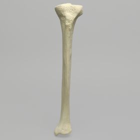 Tibia with 12 mm Canal, Foam Cortical Shell, Left, Medium
