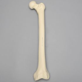 Femur with Osteoporosis, Osteoporotic Cortical Shell