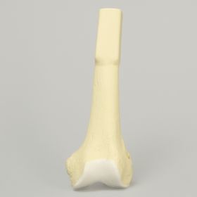 Femur with Cartilage, Distal