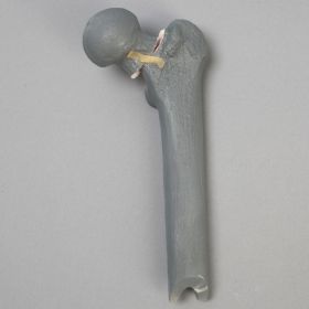 Femur with Neck Fracture, Replacement Part for #1516-39 Trainer