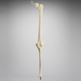 Knee Replacement with Tibia and Femur for #1301-169 and 1301-169-1