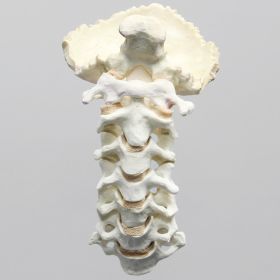 Spine, Cervical with Occipital, Posterior Ligament, and Tan Discs, Solid Foam