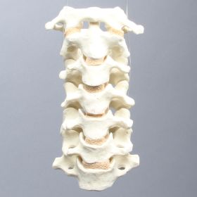 Spine, Cervical, Posterior Ligament, Solid Foam