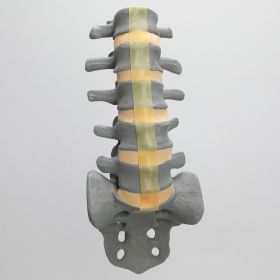 Spine, Lumbar, L1-Sacrum, Osteoporotic Vertebrae, Radiopaque