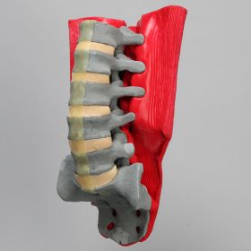 Spine, L1-Sacrum, Lumbar with Muscles, Radiopaque