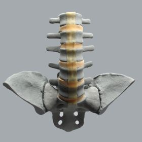 Spine, Lumbar, Bilateral Iliac Crests, Radiopaque