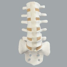 Spine, Lumbar, L1-Sacrum, Foam Cortical Shell