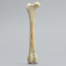 Canine Toy Breed Femur with Comminuted Midshaft Fracture