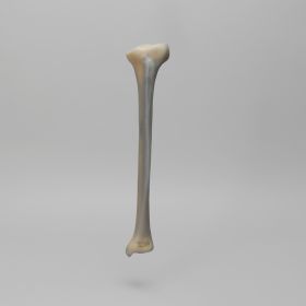Tibia, absolute™ 4th Gen., 17 PCF, Solid Foam Core with Varus Deformity, Medium