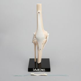 Knee ACLR Demonstrator with Removable Bone Graft