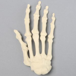 Female Hand, Arthritic, Solid Foam