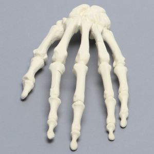 Hand, Multiple Finger Fractures, Solid Foam