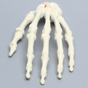Hand with Moveable Scaphoid, Solid Foam