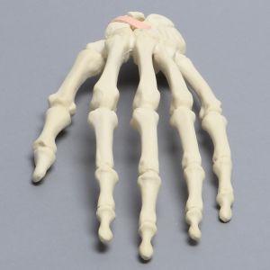 Hand with Scaphoid Fracture and Ligament, Solid Foam