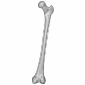 Osteoporotic Femur, Scan of #3503