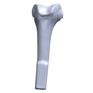 Distal Femur with Cartilage, Scan of #1130-158-1