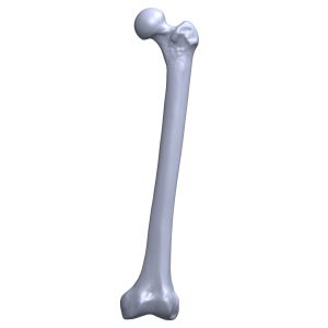 Femur with Osteoporotic Shell, Scan of #1130-130