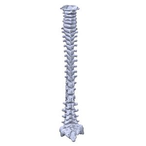 Full Pediatric Spine, Scan of #1323-30