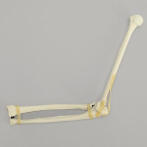 Elbow, Pediatric, Solid Foam