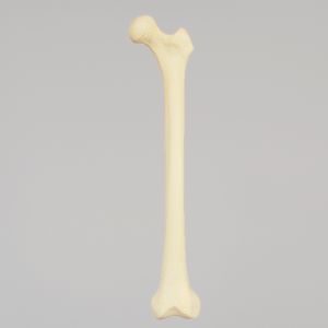 Femur with Narrow Intercondylar Notch, Foam Cortical Shell, Left