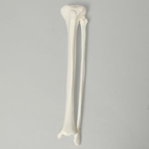 Tibia and Fibula, Plastic Cortical Shell