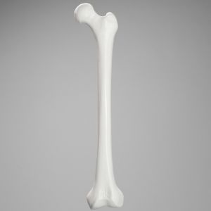 Femur with 12.5 mm Canal, Plastic Cortical Shell, Left