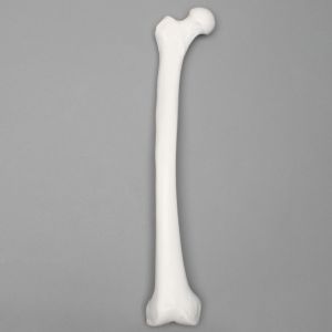 Femur with 15 mm Canal, Plastic Cortical Shell, Right