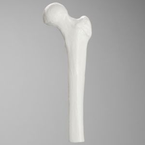 Femur, Plastic Cortical Shell, Proximal
