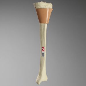 Tibia with Skin Patch, Pediatric