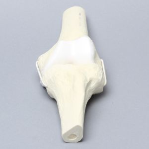 Knee Joint with Articular Cartilage