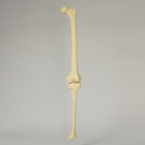 Knee with Three Non-Stretch Ligaments, Full Length
