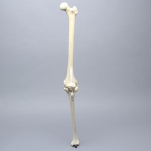 Knee with Patella, Erosions, and Three Stretch Cord Ligaments, Full Length