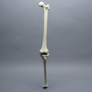 Knee with Three Stretch Tube Ligaments and Thicker Cortex, Full Length