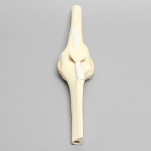 Knee Joint with Patella, Narrow Intercondylar Notch, and Four Stretch Tube Ligaments