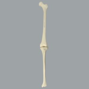 Knee with Three Nylon Non-Stretch Ligaments and Narrow Intercondylar Notch, Full Length