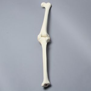 Knee with Three Stretch Tube Ligaments, Full Length, Arthritic