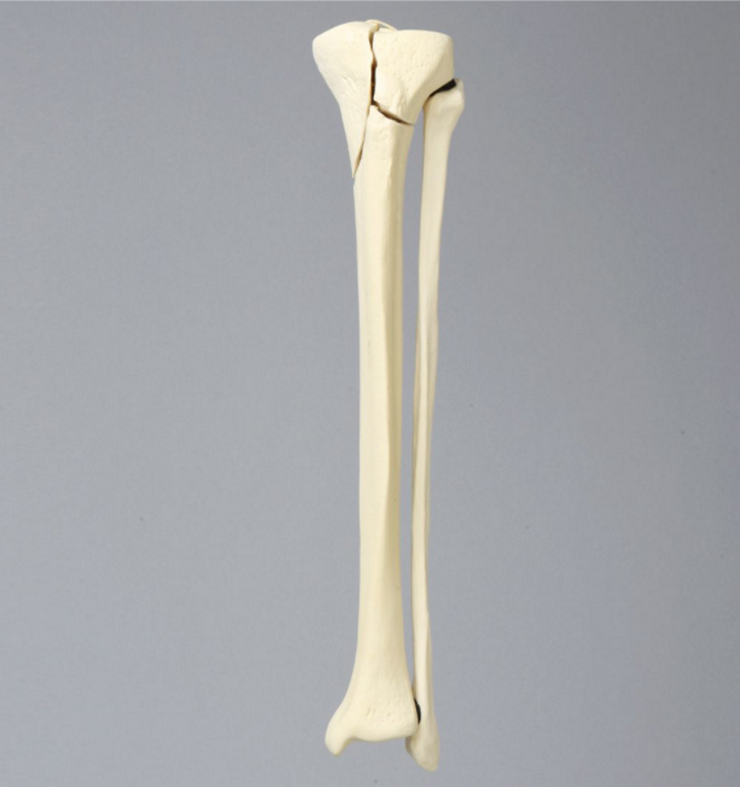 Tibia and Fibula 