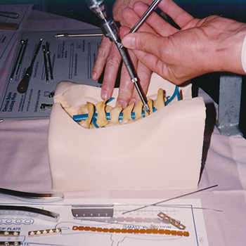 My how things have changed but also stayed the same. #tbt SICOT 1993 Sawbones cervical spine model and holder.
